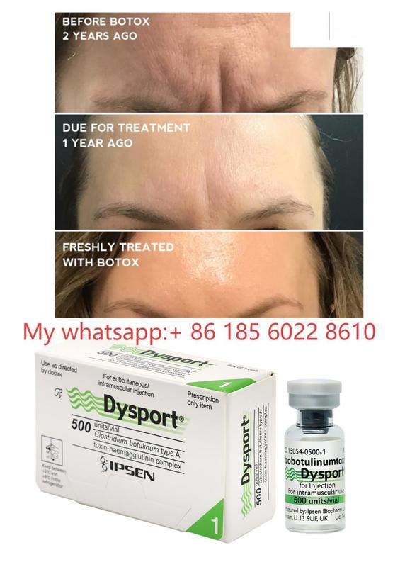 Dysport 500IU 注射 ボツリヌストキシン Allergan ボツラックス - 小じわとシワ