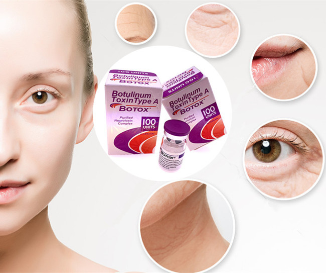 Meditoion 50の単位のBotuliunmの毒素のタイプ100単位Allergan