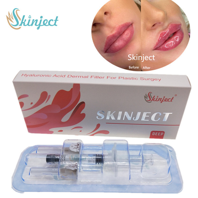 Skinjectの注射可能な深いHyaluronic酸の皮膚2ml唇の注入口
