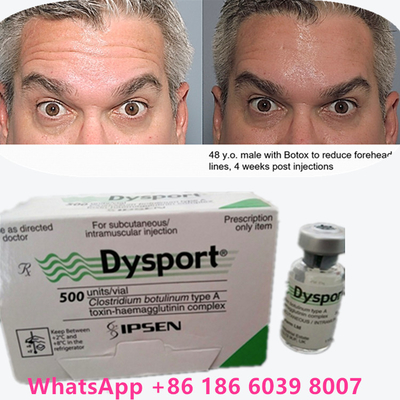 ボトリン毒素 ボトックス粉 100 IU/1 錠 皮膚老化