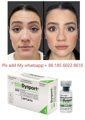 Dysport 500iu 注射 アンチリンクル ボツリヌストキシン Allergan Botulax